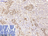 CD15 Monoclonal Antibody