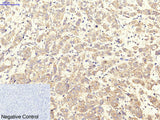 ITGA2B Monoclonal Antibody