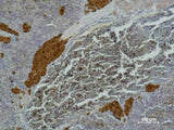 IL2RA Monoclonal Antibody