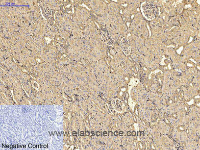 ACTA2 Monoclonal Antibody Store at -20°C