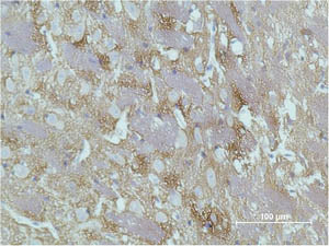 GAP43 Monoclonal Antibody