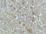 GAP43 Monoclonal Antibody