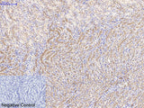 Catenin Beta Monoclonal Antibody