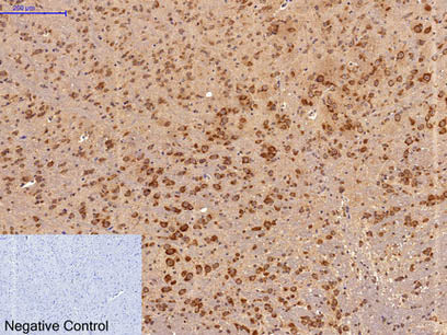 Survivin Monoclonal Antibody