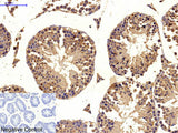 MICU1 Monoclonal Antibody