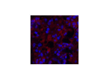 MICU1 Monoclonal Antibody