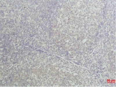 TNF Alpha Monoclonal Antibody Store at -20°C