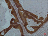 STAT3 Monoclonal Antibody