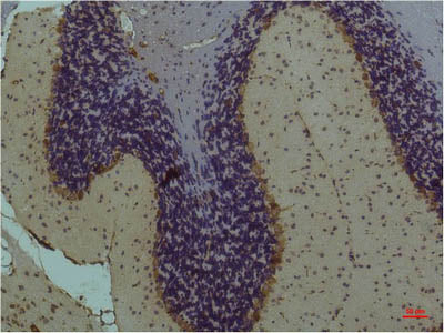 STAT3 Monoclonal Antibody