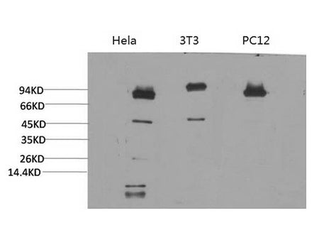 STAT3 Monoclonal Antibody