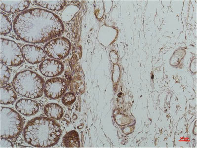 HSPA5 Monoclonal Antibody