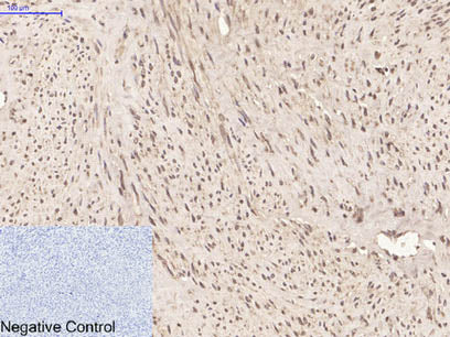 PPIB Monoclonal Antibody