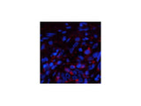 PPIB Monoclonal Antibody
