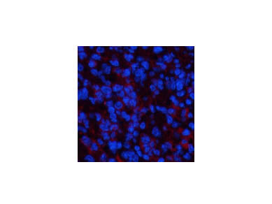 PPARD Monoclonal Antibody Store at -20°C
