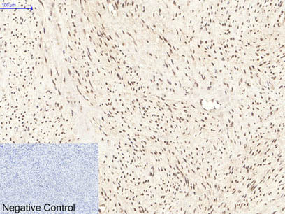 PPARD Monoclonal Antibody Store at -20°C