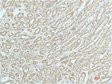 ACTN1 Monoclonal Antibody