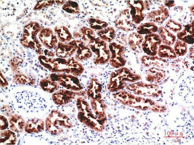 CST3 Monoclonal Antibody Store at -20°C Host Mouse