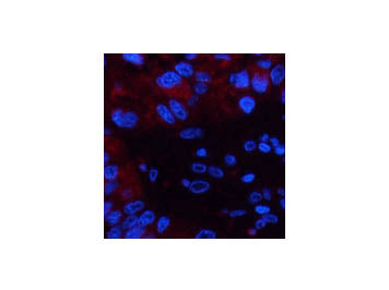 CST3 Monoclonal Antibody Store at -20°C Host Mouse