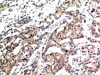 Ubiquitin Monoclonal Antibody