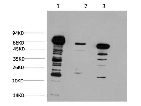 Ubiquitin Monoclonal Antibody