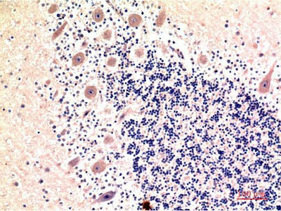 MAP1LC3B Monoclonal Antibody Store at -20°C