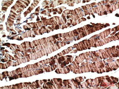ACTA1 Monoclonal Antibody