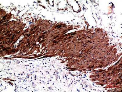 ACTA1 Monoclonal Antibody