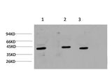 ACTA1 Monoclonal Antibody