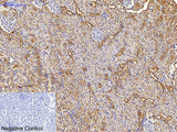 MAP1LC3A Monoclonal Antibody