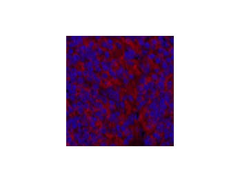 MAP1LC3A Monoclonal Antibody
