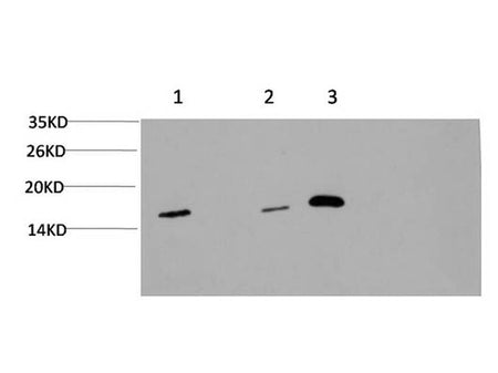 MAP1LC3A Monoclonal Antibody