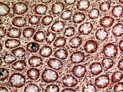 Gamma Tubulin Monoclonal Antibody