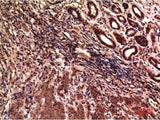 Gamma Tubulin Monoclonal Antibody