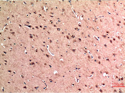 BECN1 Monoclonal Antibody