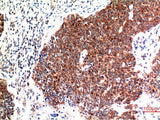 BECN1 Monoclonal Antibody
