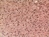 Tau Monoclonal Antibody