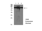 Tau Monoclonal Antibody