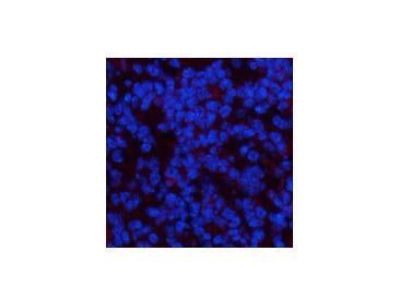 PDGFRA Monoclonal Antibody