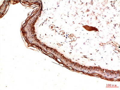 PDGFRA Monoclonal Antibody