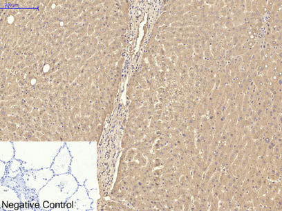 TTR Monoclonal Antibody