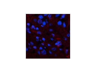 TTR Monoclonal Antibody