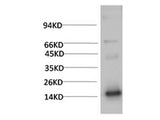 TTR Monoclonal Antibody