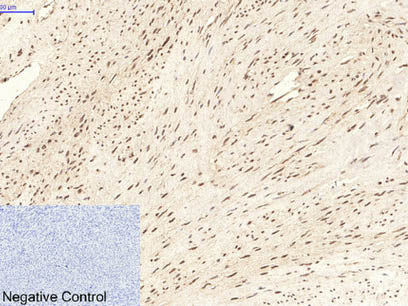 CBX5 Monoclonal Antibody