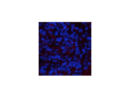 NBR1 Monoclonal Antibody