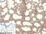 NBR1 Monoclonal Antibody