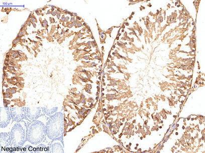 ATG5 Monoclonal Antibody