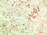 ATG5 Monoclonal Antibody