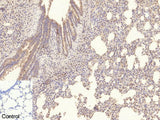 COL4A1 Monoclonal Antibody