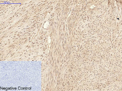 ATG7 Monoclonal Antibody