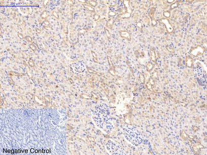 COL1A1 Monoclonal Antibody